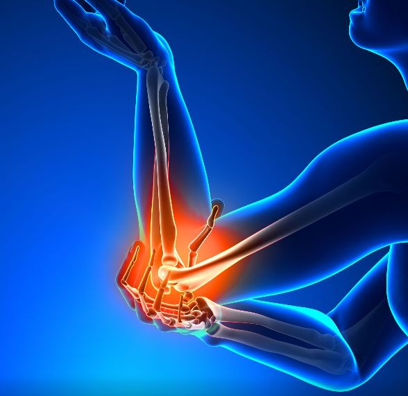 Graphic of person with pain in the elbow