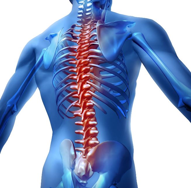 Graphic of a spine with red to indicate pain from spinal stenosis