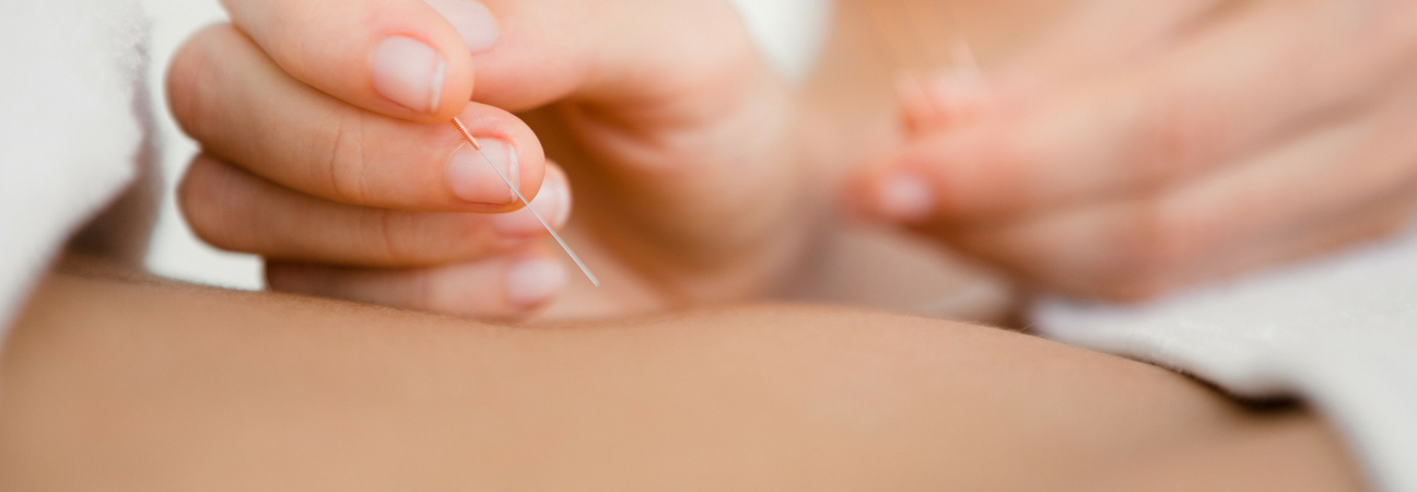 woman performing acupuncture on a patient as a non-surgical treatment option